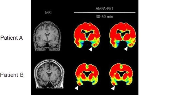 pet brain scan