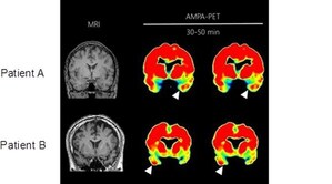 Compound Lights up Brain Receptors in PET Scans