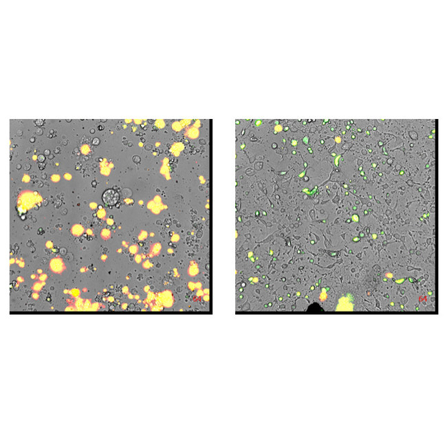 Cannabinoid extract causing necrosis in Gastrointestinal cancer cell line. The Yellow color is a marker for necrosis. On the right - control, on the left – after treatment with cannabinoids