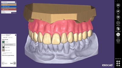 The new exocad Plovdiv release allows the design of single-arch dentures, with the simplified model analysis based on the opposing arch situation. The prosthetic tooth setup is defined with fewer clicks. With the optional Virtual Articulator module, the denture teeth can be adapted to the excursive movements of the antagonist.