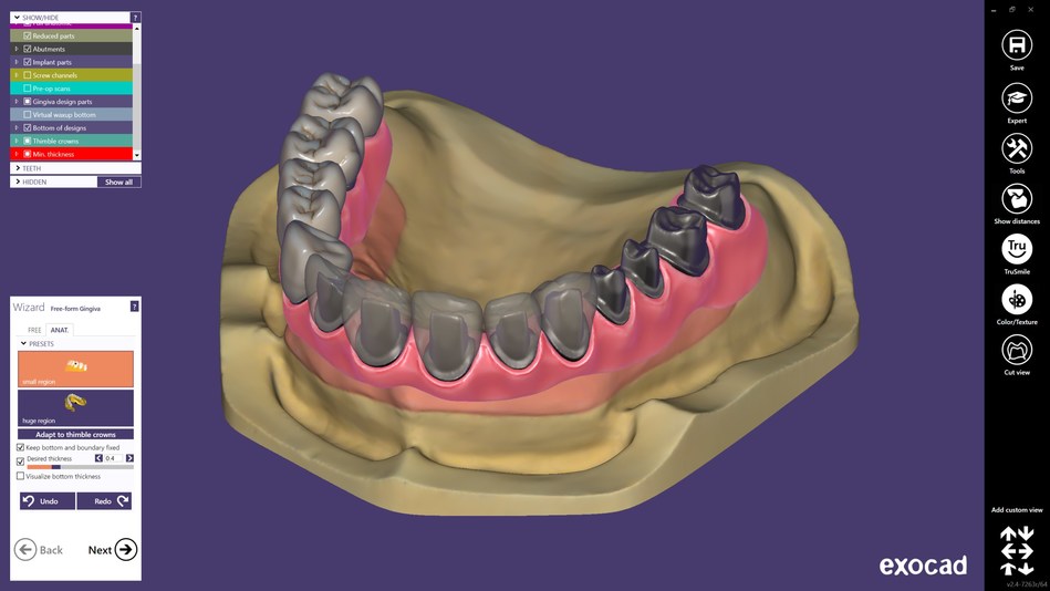 exocad DentalCAD 2.4 Plovdiv available now