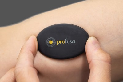 Profusa Receives CE Mark Approval to Market the Wireless Lumee® Oxygen  Platform for Continuous, Real-Time Monitoring of Tissue Oxygen