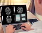 Qynapse receives FDA clearance for QyScore®, a novel imaging software for central nervous system diseases