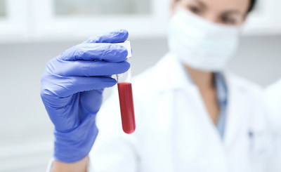 Simple blood test makes cancer detection possible at an early stage