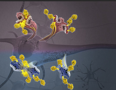 Tau filaments decorated with ubiquitin chains (yellow) from corticobasal degeneration (blue/navy) and Alzheimer's disease (red/purple) emanating from a neuron (Credit: Veronica Falconieri Hays and Anthony Fitzpatrick/Columbia University's Zuckerman Institute)