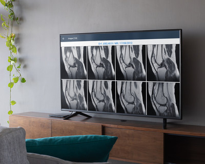 Medcloud lança app de visualização de exames para Smart TV