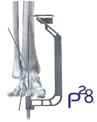 Phantom&reg; TTC Nail Precision Guide
