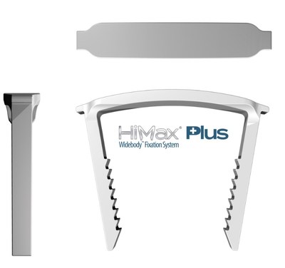 HiMax&reg; Plus Widebody&trade; Fixation System for Foot Fusions: Market Leading Compression Plus Enhanced Stability