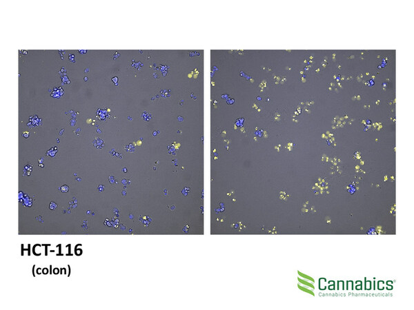 Necrotic effect of CBN on Colon Cancer: Nuclear (Blue) and Necrosis (Yellow) dyes were analyzed using fluorescent microscopy. Left: Untreated cells. Right: Cells treated with CBN.