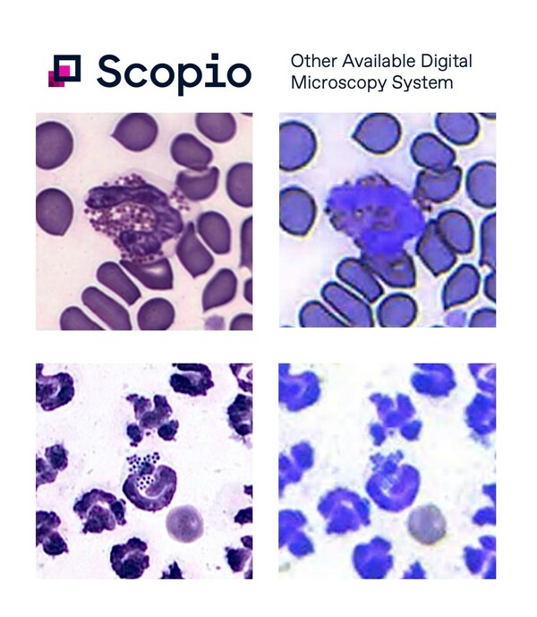 Scopio Labs’ digital microscopy image quality compared to other providers