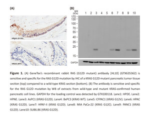 GeneTex Launches Novel Recombinant RAS (G12D Mutant) Antibody [HL10]