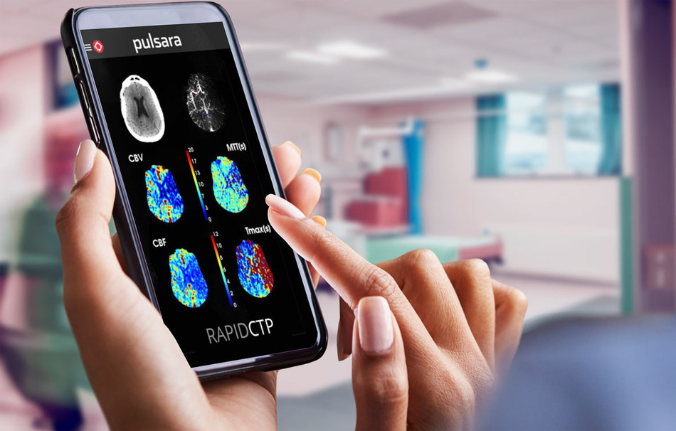With the Pulsara and RapidAI integration, all members of the care team receive an alert the instant the CT scan images are available. Faster access to results means faster mobilization of resources and ultimately faster treatment times.
