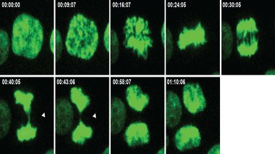 The time series shows the process of cell division, with arrows pointing to errors that lead to an imbalance in chromosome number. Research now shows that in cancer cells, chromosomal imbalance can either promote or inhibit metastasis. Photo Credit: Sheltzer lab/CSHL, 2020