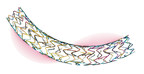 BIOTRONIK's Ultrathin Strut Orsiro Coronary Drug-Eluting Stent Continues to Deliver Excellent Results After Three Years