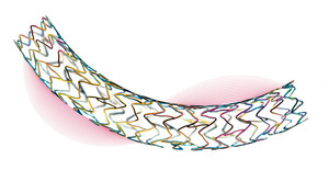 BIOTRONIK's Ultrathin Strut Orsiro Coronary Drug-Eluting Stent Continues to Deliver Excellent Results After Three Years