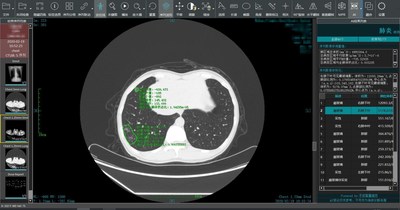 Ping An Smart Healthcare&rsquo;s smart image-reading system may conduct smart image-reading and generate smart analysis results on the frontline in epidemic area.