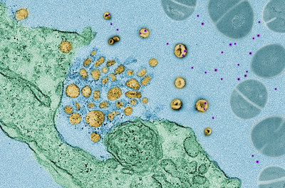 Electron microscopy images show "exosomes" (in yellow) soaking up toxins (in purple) released by bacteria (in blue), which are trying to kill a human lung cell (in green). Credit: Courtesy of Nature Electron microscopy images show "exosomes" (in yellow) soaking up toxins (in purple) released by bacteria (in blue), which are trying to kill a human lung cell (in green). Credit: Courtesy of Nature