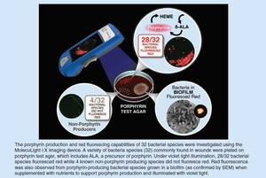Une première étude signalant la détection in vitro de la fluorescence des bactéries dans le biofilm à l'aide d'un dispositif d'imagerie de plaies au point de service est publiée