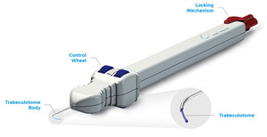 Sight Sciences Announces Publication of First-Ever Multicenter MIGS study in Childhood Glaucoma