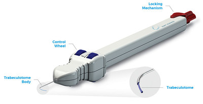 Sight Sciences TRAB360