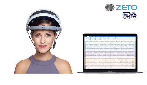 zEEG is a commercially available wireless EEG headset backed by a cloud platform that offers instant upload, tools for analysis and remote interpretation by neurologist.