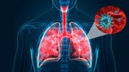 MediPines Releases COVID-19 Statement of Guidance for Pulmonary Gas Exchange Monitoring