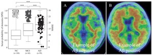 Okayama University Research: Novel Blood-based Markers to Detect Alzheimer's Disease