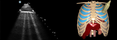 3D Systems&rsquo; new COVID-19 module to help provide hands-on experience in the education of point-of-care ultrasound skills that are essential in triage and monitoring of the coronavirus.