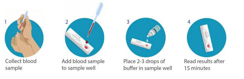 BD, BioMedomics announce the launch of a rapid serology test to detect exposure to COVID-19 at the point of care in 15 minutes. The test is completed in four, simple steps and will be available in April.