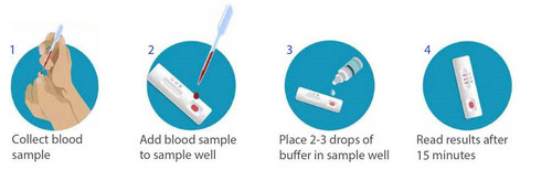 BD, BioMedomics announce the launch of a rapid serology test to detect exposure to COVID-19 at the point of care in 15 minutes. The test is completed in four, simple steps and will be available in April.