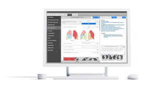 Smart Reporting Provides Free Template to Support Radiologists in Suspected COVID-19 Cases