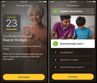 Remote Check is designed to be a convenient, at-home testing tool that allows Cochlear recipients with a Cochlear™ Nucleus® 7 Sound Processor to complete a series of hearing tests from their compatible iOS device using the Nucleus Smart App. Results are then sent remotely to the recipient’s clinic for review by their clinician, so a clinician can quickly determine whether a patient is progressing well, or whether further clinical intervention is required.
