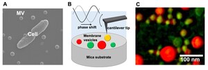 Kanazawa University Research: Atomic Force Microscopy Reveals High Heterogeneity in Bacterial Membrane Vesicles