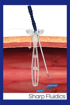 neoClose, a laparoscopic and robotic port site closure technology now available from Sharp Fluidics.