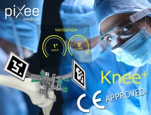 Vuzix announces the World's First Orthopedic Navigation System Using Augmented Reality Smart Glasses developed by Pixee Medical