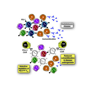 Novel CAR NK-cell technology could lead to new treatments for lupus, other incurable diseases