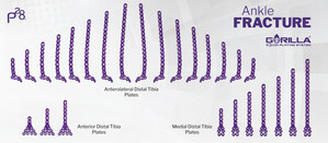 Paragon 28® Increases its Robust Ankle Fracture Offering - Gorilla® Ankle Fracture Pilon Plating System Launched