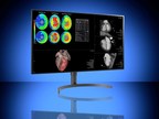 Double Black Imaging Brings LG's Cutting-Edge Display Systems to Radiology Imaging Markets