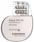 New Study Shows Two-Lead CRT-DX System Can Provide Equivalent Therapy With Fewer Complications