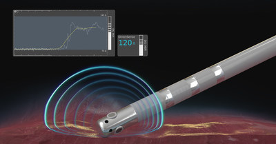 The DIRECTSENSE Technology provides data on the impedance around the catheter tip to measure the ability of the tissue to respond to radiofrequency energy before physicians deliver therapy.
