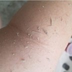 Baiden Skincare Company Comes Clean About Effects of its Products on Keratosis Pilaris (aka KP, Chicken Skin or Bumpy Skin)