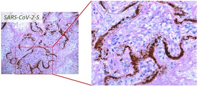 RNAscope_SARS_COV2_Placenta image