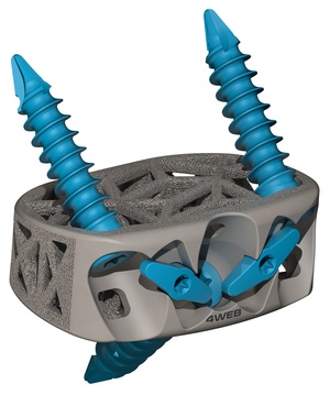 4WEB Medical Announces Launch of Stand-Alone Anterior Lumbar Spine Truss System