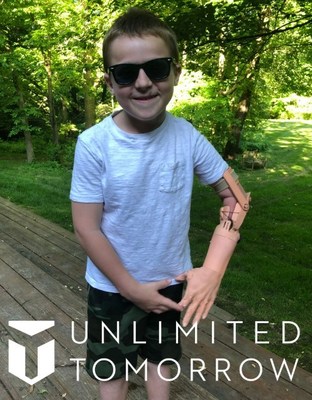 7 year old TrueLimb user, Connor