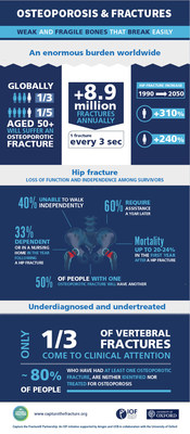 Despite its serious outcomes, osteoporosis remains vastly underdiagnosed and undertreated, particularly among individuals who have already broken a bone, and who are at high risk of suffering further fractures. The Capture the Fracture® Partnership aims to proactively implement post-fracture care coordination programs in hospitals and healthcare systems, to help prevent subsequent fractures due to osteoporosis, and improve patient care.