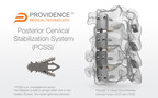 Providence Medical Technology Announces First Patient Enrollment in the "FUSE" IDE Clinical Study
