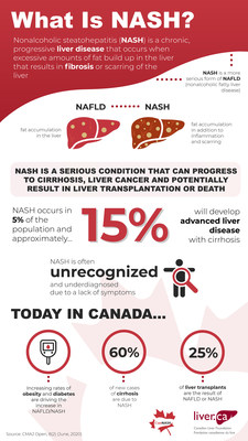 First National Study Predicts an Escalating Epidemic of Nonalcoholic Fatty Liver Disease (NAFLD) (CNW Group/CanNASH)