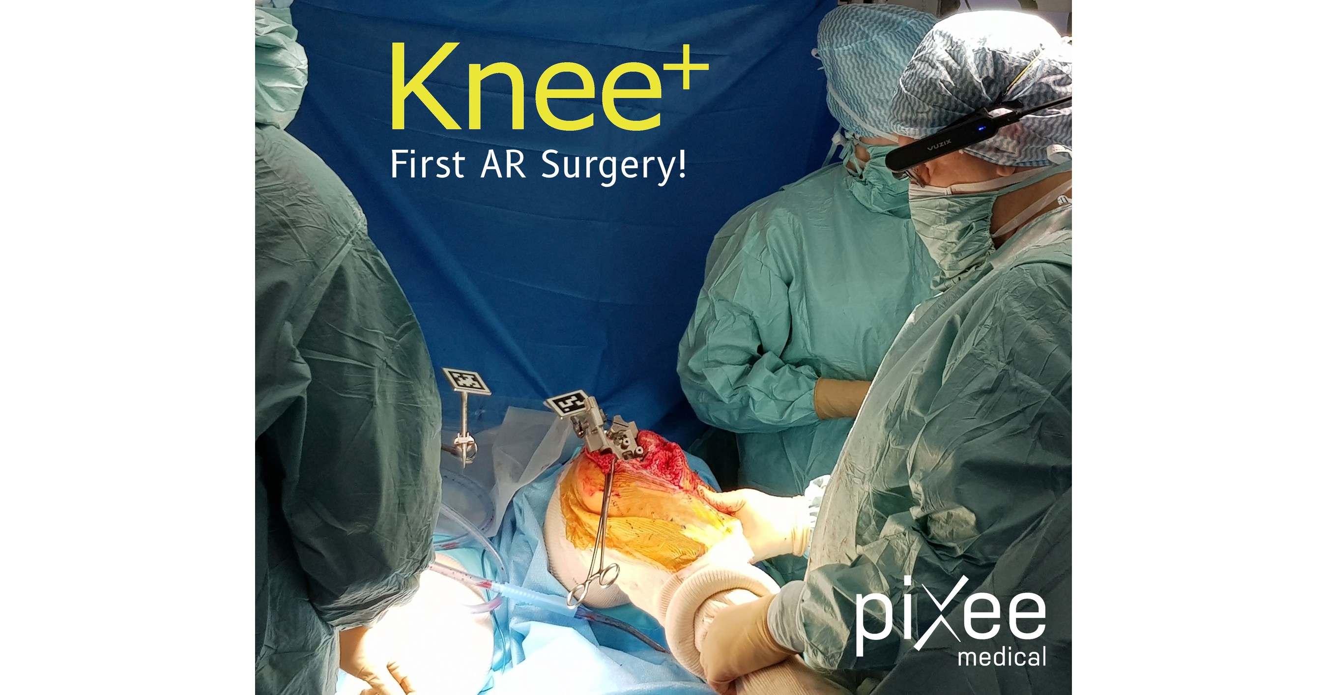 First Knee Replacement Surgery Successfully Completed Using Augmented
