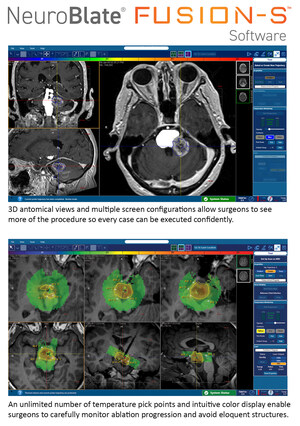 Monteris Announces FDA Clearance of NeuroBlate Fusion-S™ Software