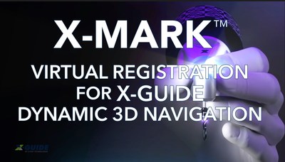 X-Mark Virtual-Based Dental Implant Navigation Surgery